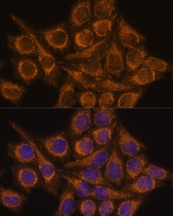 Invitrogen PYCR2 Polyclonal Antibody 100 μL; Unconjugated:Antibodies,