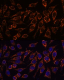 Invitrogen PYCR2 Polyclonal Antibody 100 μL; Unconjugated:Antibodies,