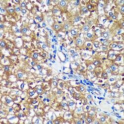 Invitrogen PYCR2 Polyclonal Antibody 100 μL; Unconjugated:Antibodies,