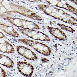 Invitrogen HDAC9 Polyclonal Antibody 100 &mu;L; Unconjugated:Antibodies,