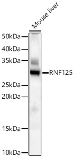 Invitrogen TRAC-1 Polyclonal Antibody 100 &mu;L; Unconjugated:Antibodies,