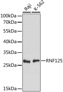 TRAC-1 Polyclonal Antibody:Antibodies, Polyclonal