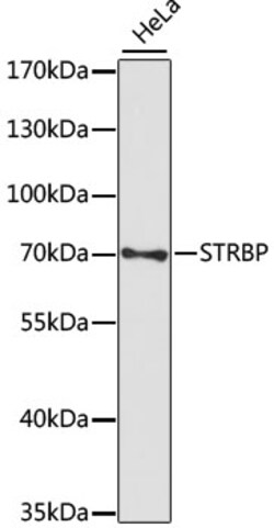 Invitrogen STRBP Polyclonal Antibody 100 &mu;L | Buy Online | Invitrogen&trade; | Fisher Scientific