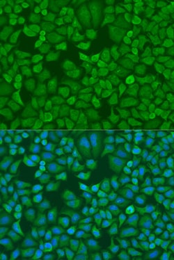 Invitrogen IGF2BP1 Polyclonal Antibody 100 &mu;L; Unconjugated:Antibodies,