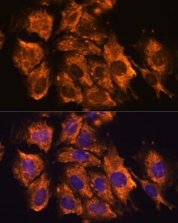 Invitrogen CRELD1 Polyclonal Antibody 100 &mu;L; Unconjugated:Antibodies,