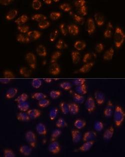 Invitrogen CRELD1 Polyclonal Antibody 100 &mu;L; Unconjugated:Antibodies,