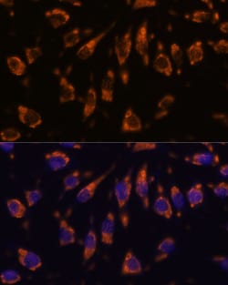 Invitrogen CRELD1 Polyclonal Antibody 100 &mu;L; Unconjugated:Antibodies,