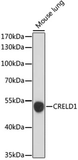 Invitrogen CRELD1 Polyclonal Antibody 100 &mu;L; Unconjugated:Antibodies,