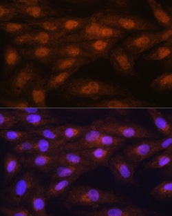 Invitrogen PRMT5 Polyclonal Antibody 100 &mu;L; Unconjugated:Antibodies,