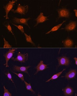 Invitrogen PRMT5 Polyclonal Antibody 100 &mu;L; Unconjugated:Antibodies,