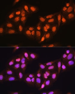 Invitrogen PRMT5 Polyclonal Antibody 100 &mu;L; Unconjugated:Antibodies,