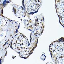 Invitrogen PRMT5 Polyclonal Antibody 100 &mu;L; Unconjugated:Antibodies,