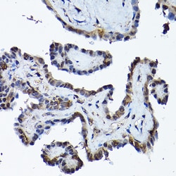 Invitrogen PRMT5 Polyclonal Antibody 100 &mu;L; Unconjugated:Antibodies,