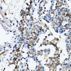 Invitrogen PRMT5 Polyclonal Antibody 100 &mu;L; Unconjugated:Antibodies,