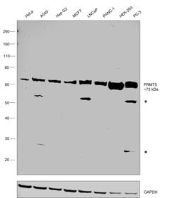 Invitrogen PRMT5 Polyclonal Antibody 100 &mu;L; Unconjugated:Antibodies,