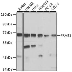 Invitrogen PRMT5 Polyclonal Antibody 100 &mu;L; Unconjugated:Antibodies,