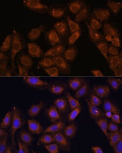 Invitrogen UPF1 Polyclonal Antibody 100 &mu;L; Unconjugated:Antibodies,