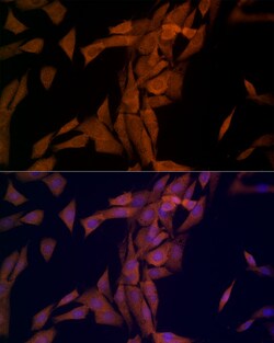 Invitrogen OTUD4 Polyclonal Antibody 100 &mu;L; Unconjugated:Antibodies,