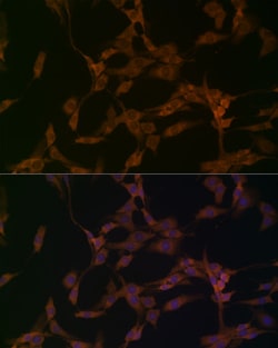 Invitrogen OTUD4 Polyclonal Antibody 100 &mu;L; Unconjugated:Antibodies,