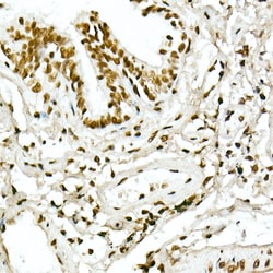Invitrogen H4K5ac Polyclonal Antibody 100 &mu;L; Unconjugated:Antibodies,