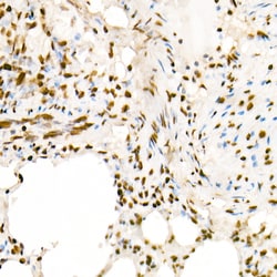 Invitrogen H4K5ac Polyclonal Antibody 100 &mu;L; Unconjugated:Antibodies,