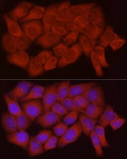 Caspase 7 p11 Polyclonal Antibody:Antibodies, Polyclonal