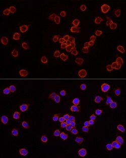 Caspase 7 p11 Polyclonal Antibody:Antibodies, Polyclonal