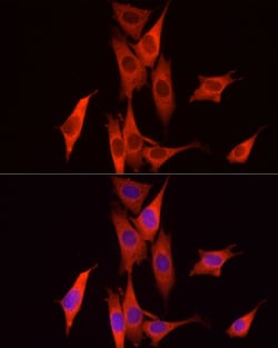 Caspase 7 p11 Polyclonal Antibody:Antibodies, Polyclonal