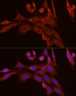 Caspase 7 p11 Polyclonal Antibody:Antibodies, Polyclonal