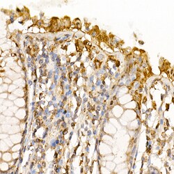 Caspase 7 p11 Polyclonal Antibody:Antibodies, Polyclonal