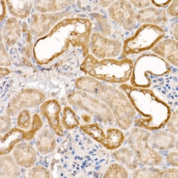Caspase 7 p11 Polyclonal Antibody:Antibodies, Polyclonal
