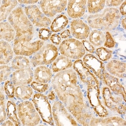 Caspase 7 p11 Polyclonal Antibody:Antibodies, Polyclonal