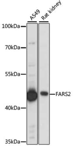 Invitrogen FARS2 Polyclonal Antibody 100 &mu;L; Unconjugated:Antibodies,