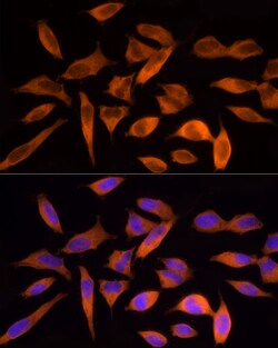 Invitrogen ATP Citrate Lyase Polyclonal Antibody 100 &mu;L; Unconjugated:Antibodies,