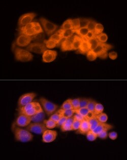 Invitrogen ATP Citrate Lyase Polyclonal Antibody 100 &mu;L; Unconjugated:Antibodies,