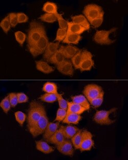 Invitrogen ATP Citrate Lyase Polyclonal Antibody 100 &mu;L; Unconjugated:Antibodies,