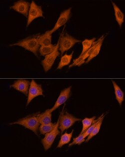 Invitrogen ATP Citrate Lyase Polyclonal Antibody 100 &mu;L; Unconjugated:Antibodies,