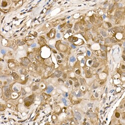 Invitrogen ATP Citrate Lyase Polyclonal Antibody 100 &mu;L; Unconjugated:Antibodies,