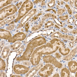 Invitrogen ATP Citrate Lyase Polyclonal Antibody 100 &mu;L; Unconjugated:Antibodies,