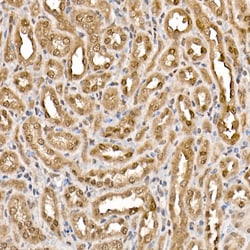 Invitrogen ATP Citrate Lyase Polyclonal Antibody 100 &mu;L; Unconjugated:Antibodies,