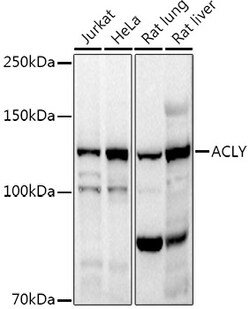 Invitrogen ATP Citrate Lyase Polyclonal Antibody 100 &mu;L; Unconjugated:Antibodies,