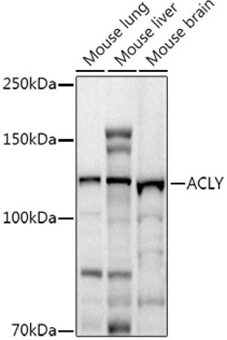 Invitrogen ATP Citrate Lyase Polyclonal Antibody 100 &mu;L; Unconjugated:Antibodies,