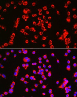 Invitrogen Catenin alpha-1 Polyclonal Antibody 100 &mu;L; Unconjugated:Antibodies,