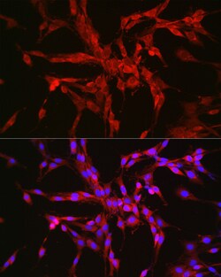 Invitrogen Catenin alpha-1 Polyclonal Antibody 100 &mu;L; Unconjugated:Antibodies,