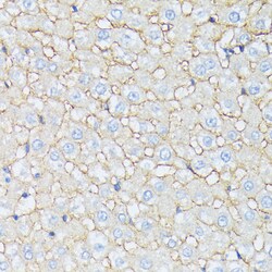 Invitrogen Catenin alpha-1 Polyclonal Antibody 100 &mu;L; Unconjugated:Antibodies,