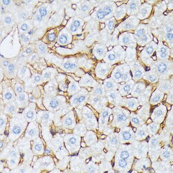 Invitrogen Catenin alpha-1 Polyclonal Antibody 100 &mu;L; Unconjugated:Antibodies,
