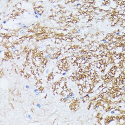 Invitrogen Catenin alpha-1 Polyclonal Antibody 100 &mu;L; Unconjugated:Antibodies,