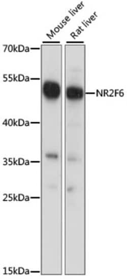 Invitrogen EAR2 Polyclonal Antibody 100 &mu;L | Buy Online | Invitrogen&trade; | Fisher Scientific