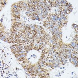 Invitrogen KID Polyclonal Antibody 100 &mu;L; Unconjugated:Antibodies,