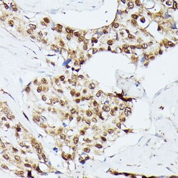 Invitrogen KID Polyclonal Antibody 100 &mu;L; Unconjugated:Antibodies,